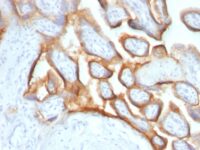 FFPE human placenta sections stained with 100 ul anti-HCG-alpha (clone SPM552) at 1:400. HIER epitope retrieval prior to staining was performed in .